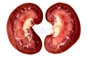 Picture of Goat, Lamb, Sheep Kidney